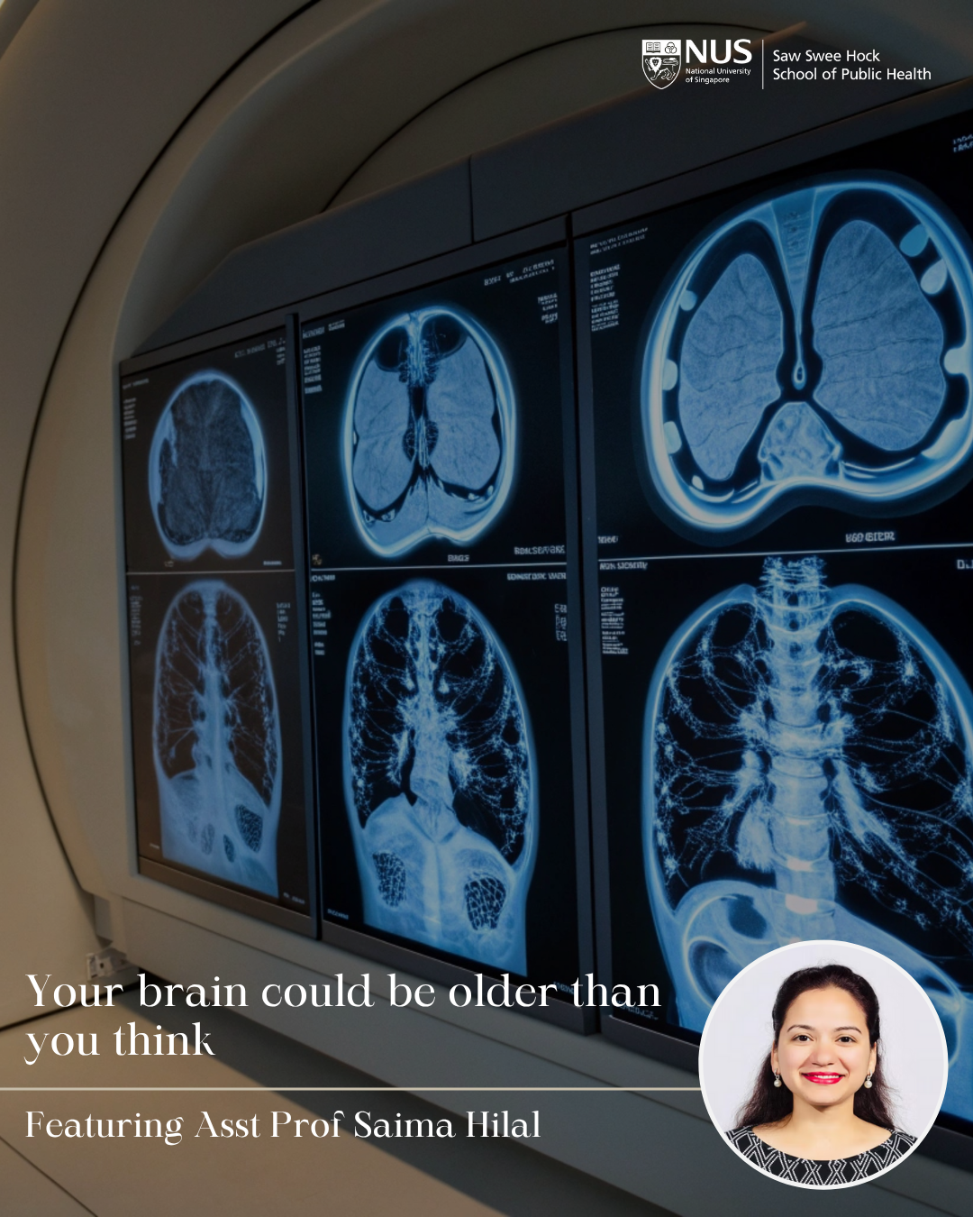 Your-brain-could-be-older-than-you-think